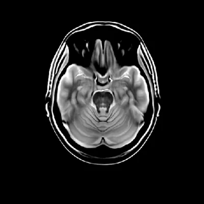TestHuman
